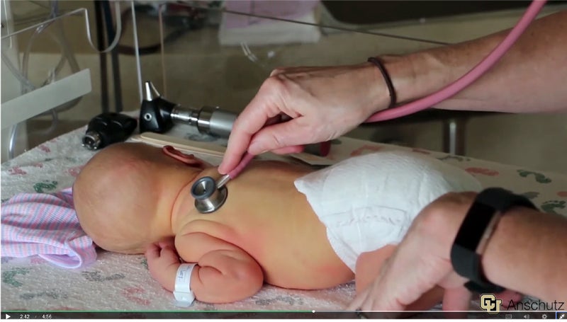 Image from the CU Anschutz Coursera course Newborn Exam: Assessment from Head to Toe.