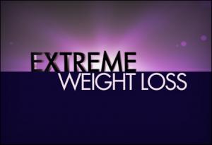 ‘Extreme Weight Loss’ returns to CU Anschutz Health and Wellness Center