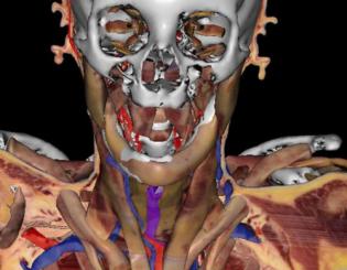Virtual human — a living cadaver — pushes boundaries of anatomical science 