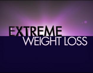 ‘Extreme Weight Loss’ returns to CU Anschutz Health and Wellness Center