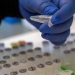 CU Anschutz researchers roll out antibody test 